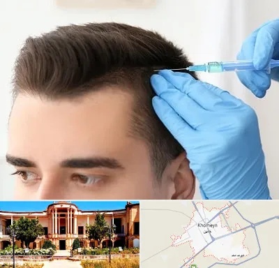 مزوتراپی مو در خمین