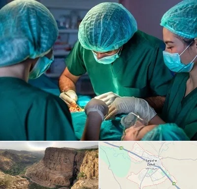 عمل کوچک کردن سینه در سرپل ذهاب