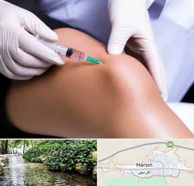 پلاسما درمانی PRP در هرسین