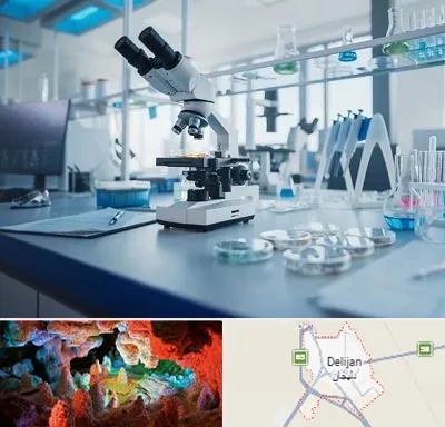 آزمایشگاه زگیل تناسلی در دلیجان