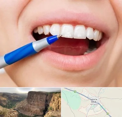 دندانسازی ارزان در سرپل ذهاب