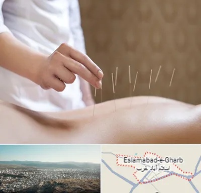 درای نیدلینگ در اسلام آباد غرب