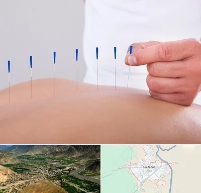 دکتر طب سوزنی در اسدآباد