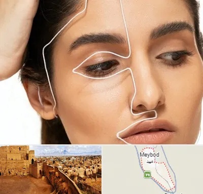 عمل بینی اقساطی در میبد