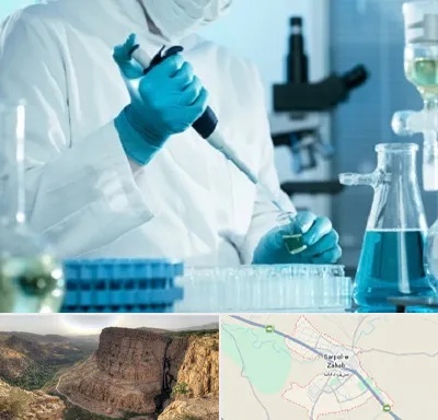 آزمایشگاه HIV در سرپل ذهاب