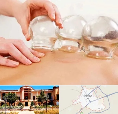 بادکش درمانی در خمین