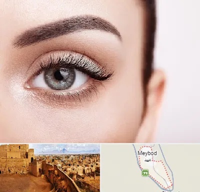 فوق تخصص عنبیه در میبد