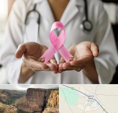 دکتر سرطان پستان در سرپل ذهاب