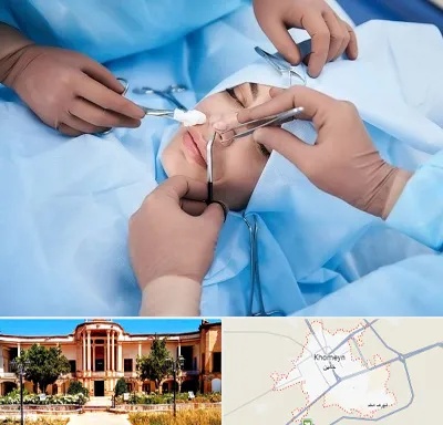 عمل بینی فانتزی در خمین