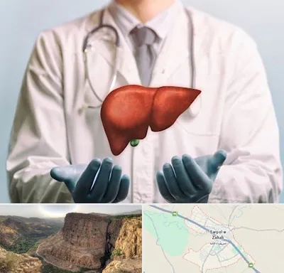 جراح سرطان کبد در سرپل ذهاب