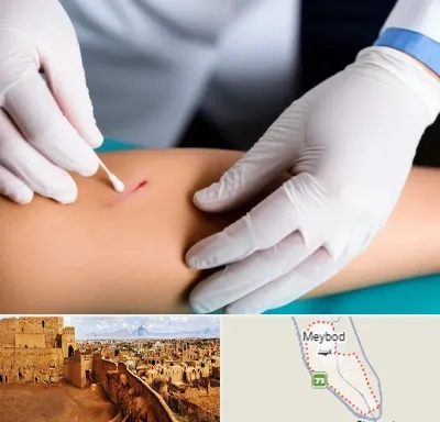 متخصص زخم عفونی در میبد