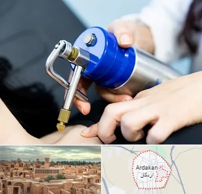 کرایوتراپی در اردکان
