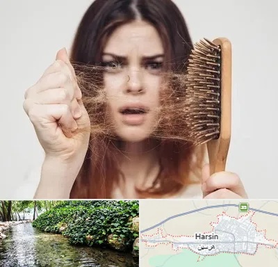 دکتر ریزش مو در هرسین