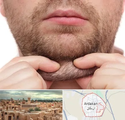 ساکشن غبغب در اردکان