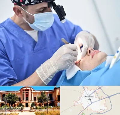 جراح سرطان چشم در خمین