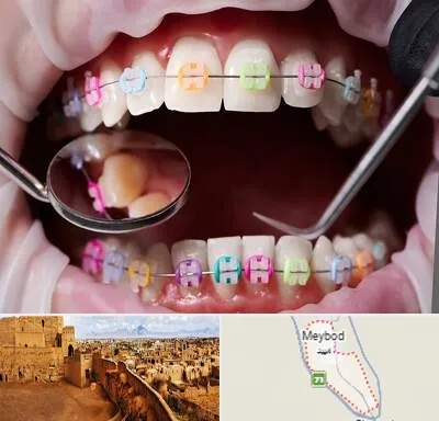 متخصص ارتودنسی در میبد