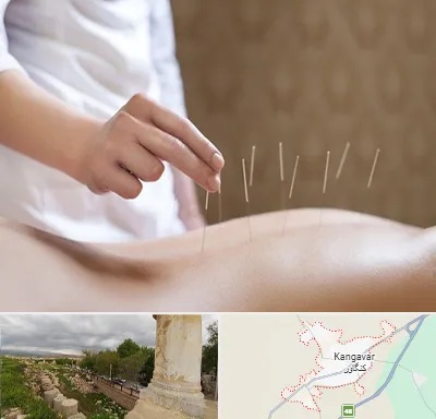 درای نیدلینگ در کنگاور
