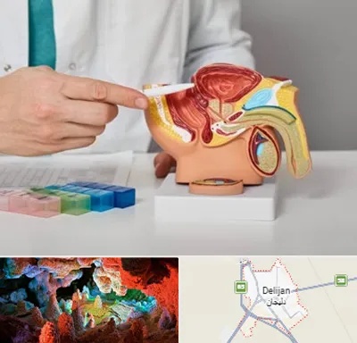 دکتر پروستات در دلیجان