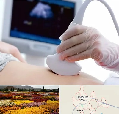 سونوگرافی در محلات