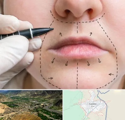 عمل سانترال لب در اسدآباد