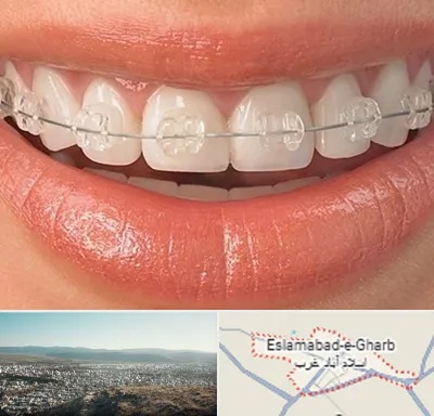ارتودنسی اقساطی در اسلام آباد غرب