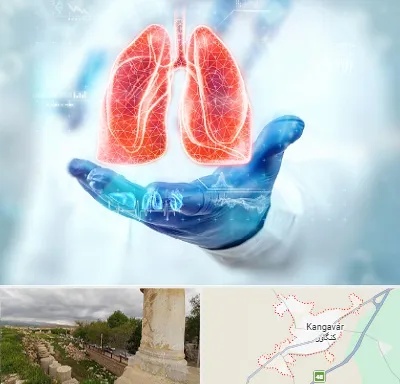 بیمارستان ریه در کنگاور
