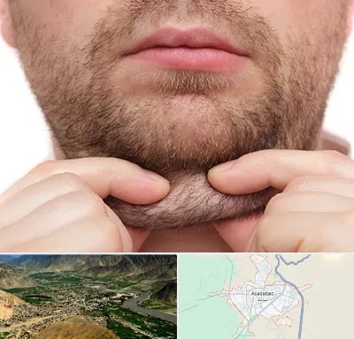 ساکشن غبغب در اسدآباد