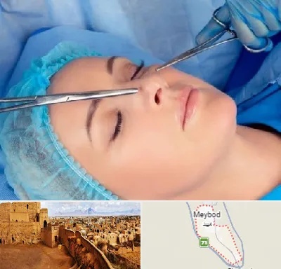 عمل بینی نیمه فانتزی در میبد
