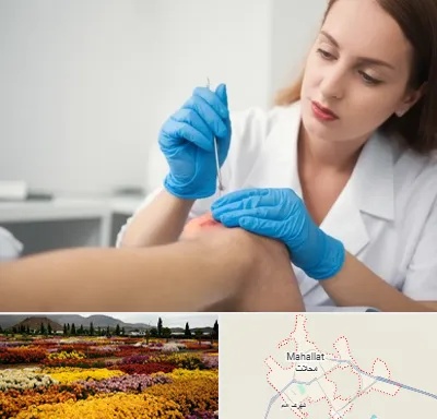 متخصص زخم در محلات