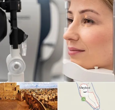 دکتر فوق تخصص چشم در میبد