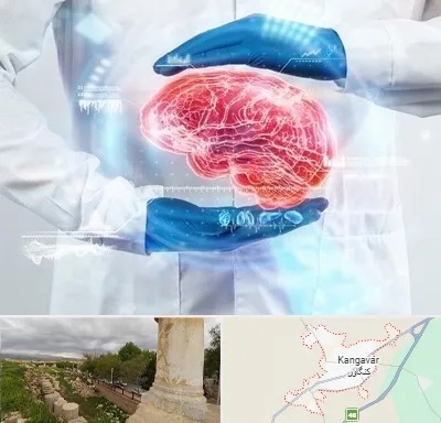 دکتر مغز و اعصاب در کنگاور