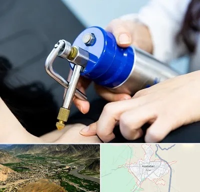 کرایوتراپی در اسدآباد