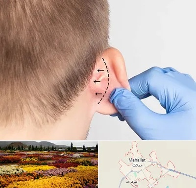 عمل زیبایی گوش در محلات