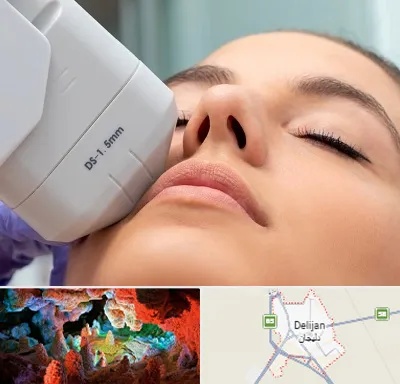 هایفوتراپی در دلیجان