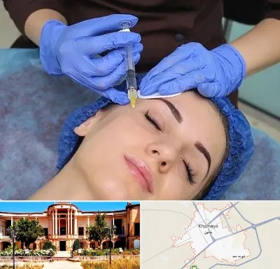 تزریق پروفایلو در خمین