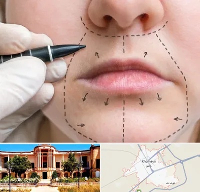 عمل سانترال لب در خمین