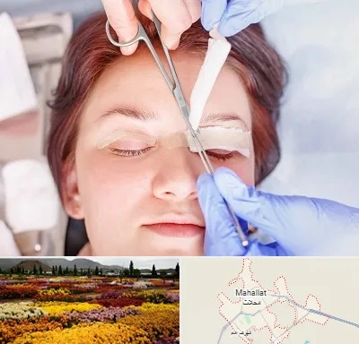 جراحی پلک افتاده در محلات