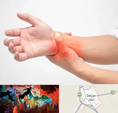 دکتر متخصص دست در دلیجان