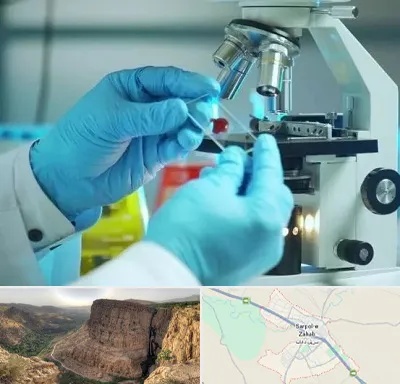 آزمایشگاه با جواب فوری در سرپل ذهاب