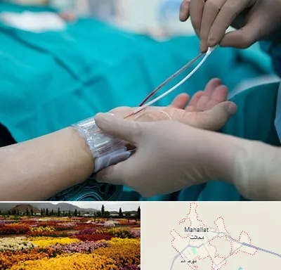آنژیوگرافی در محلات