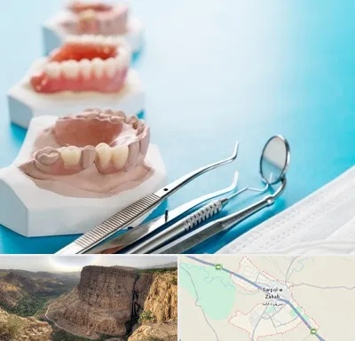 متخصص روکش دندان در سرپل ذهاب