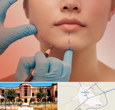 دکتر زیبایی خانم در خمین