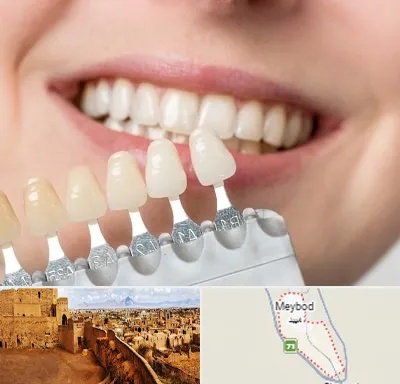 مرکز کامپوزیت دندان در میبد