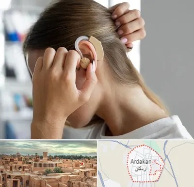 فروش اقساطی سمعک در اردکان