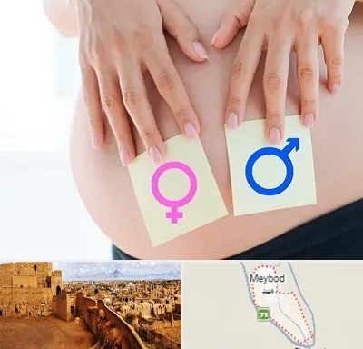 کلینیک تعیین جنسیت در میبد
