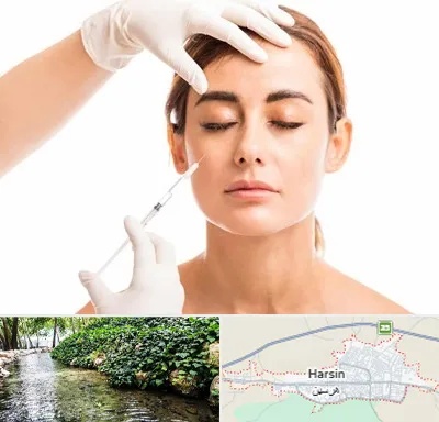 تزریق ژل گونه در هرسین