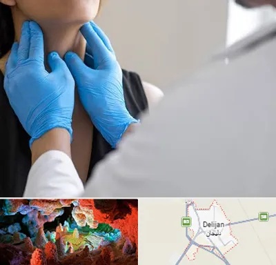 دکتر سرطان گلو در دلیجان