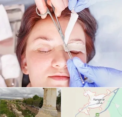 جراحی پلک افتاده در کنگاور
