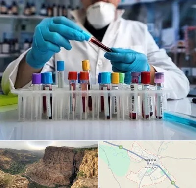 آزمایشگاه خون در سرپل ذهاب