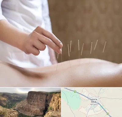 درای نیدلینگ در سرپل ذهاب